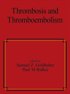 cover image of Thrombosis and Thromboembolism